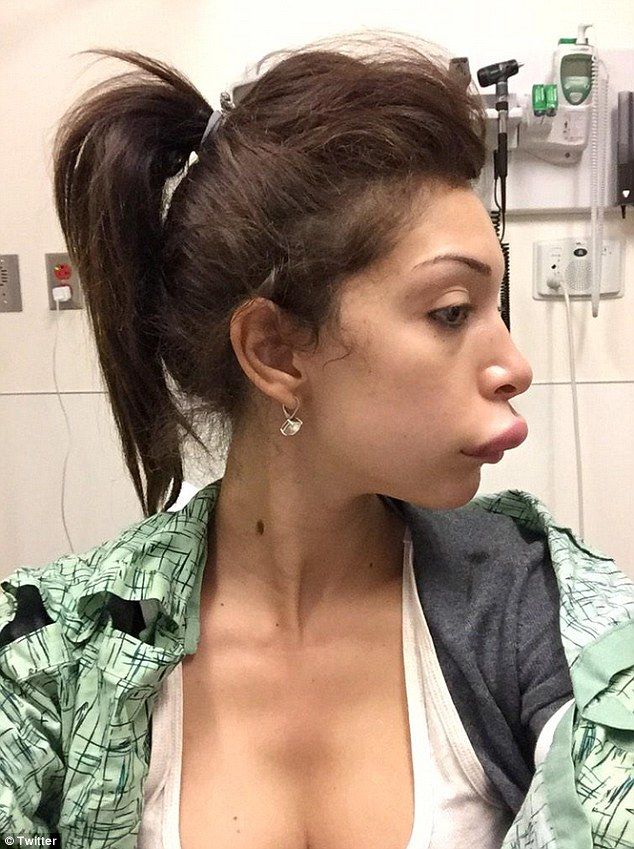 Farrah Abraham Shows Off Her Completely Botched Lip Injections Dose Of Funny